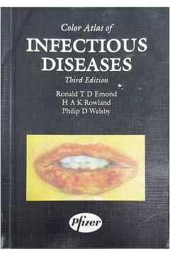 Colour Atlas of Infectious Diseases