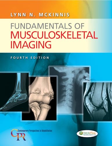 Fundamentals of Musculoskeletal Imaging (Contemporary Perspectives in Rehabilitation)