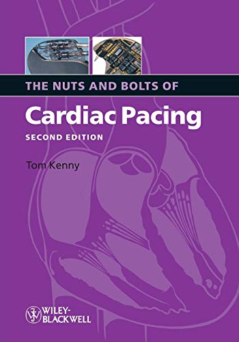 The Nuts and Bolts of Cardiac Pacing 2nd Edition by Kenny, Tom (2008) Paperback