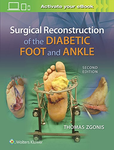 Surgical Reconstruction of the Diabetic Foot and Ankle