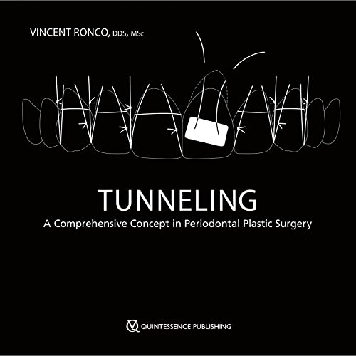 Tunneling: A Comprehensive Concept in Periodontal Plastic Surgery