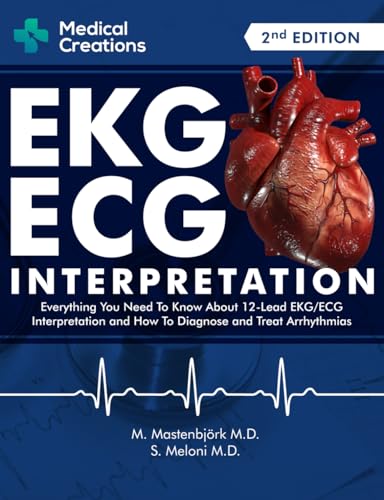 EKG_ECG Interpretation: Everything you Need to Know about the 12 - Lead ECG_EKG Interpretation and How to Diagnose and Treat Arrhythmias