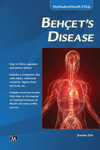 Behcet’s Disease (MyModernHealth FAQs)