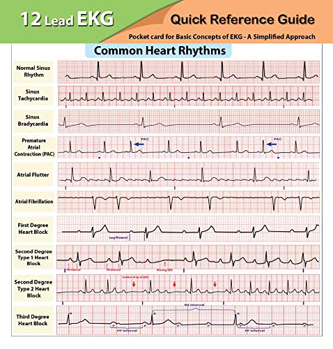 EKG Pocket Card