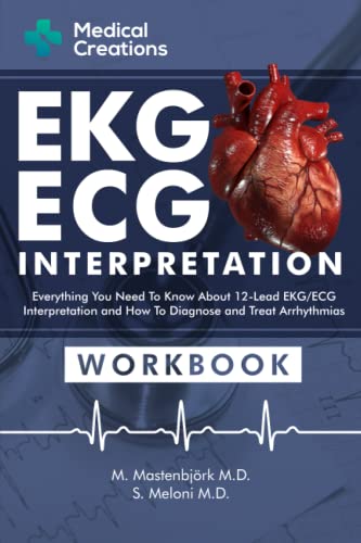 EKG_ECG Interpretation: Everything you Need to Know about the 12 - Lead ECG_EKG Interpretation and How to Diagnose and Treat Arrhythmias: Workbook