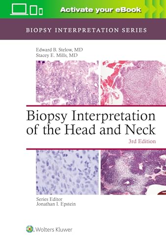 Biopsy Interpretation of the Head and Neck (Biopsy Interpretation Series)