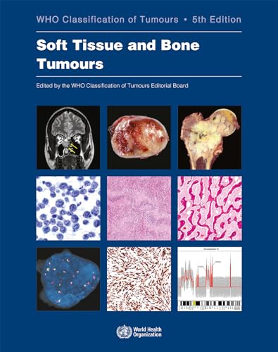 Soft Tissue and Bone Tumours: WHO Classification of Tumours (Medicine)